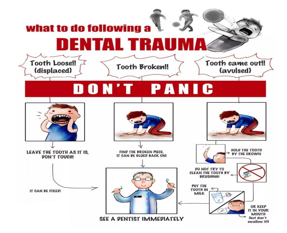 Had an accident to damage your teeth? What to do following dental trauma